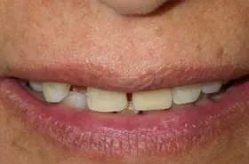 Before