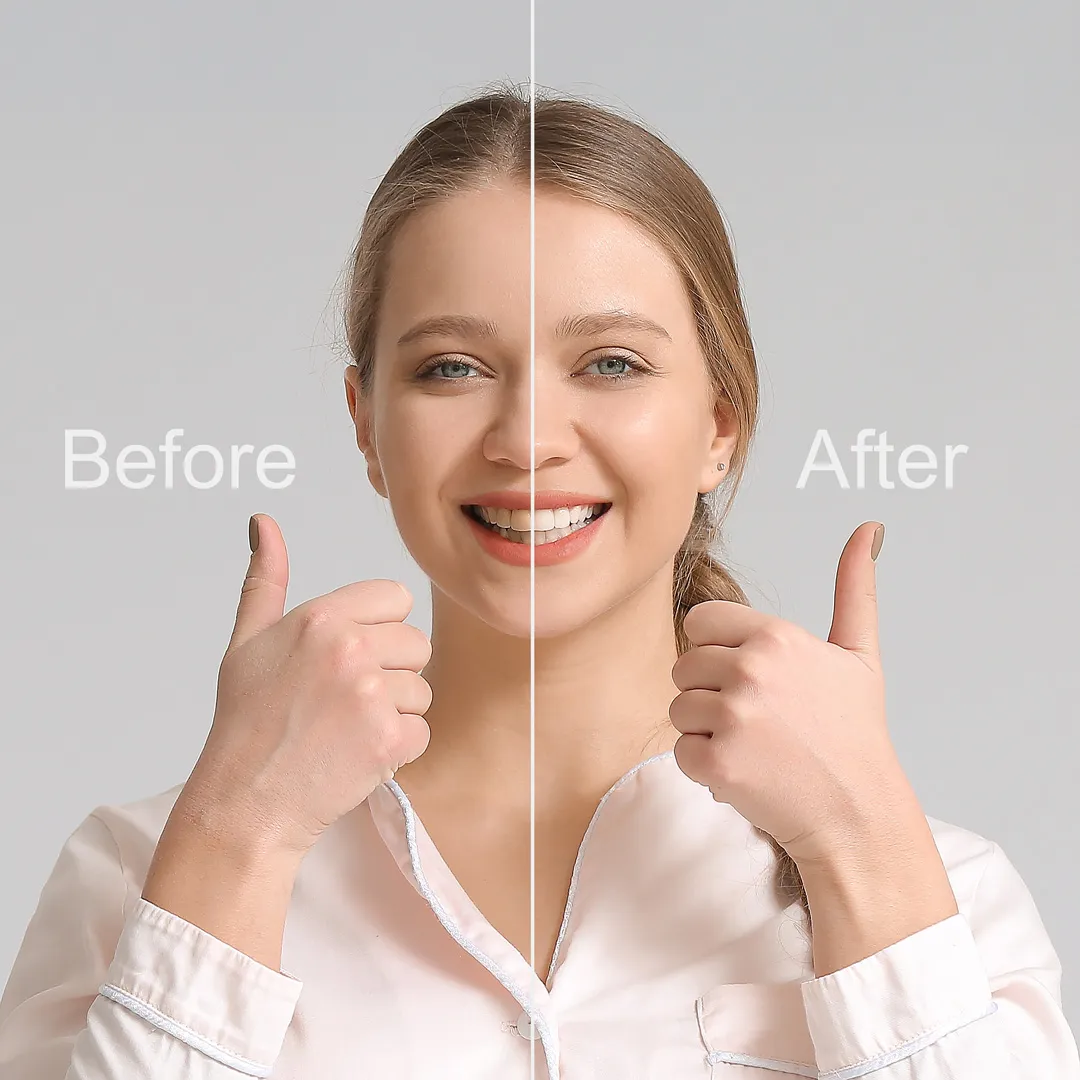 Smile Makeovers